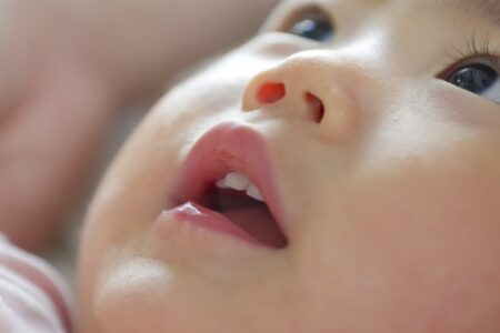 お口の“動き”がうまく育っていない状態